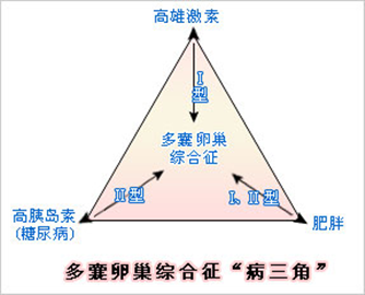 多囊暖巢综合征