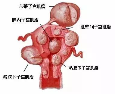 女性私护