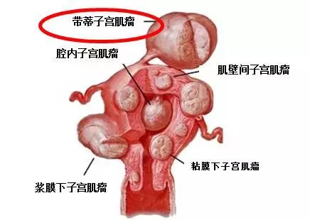女性私护