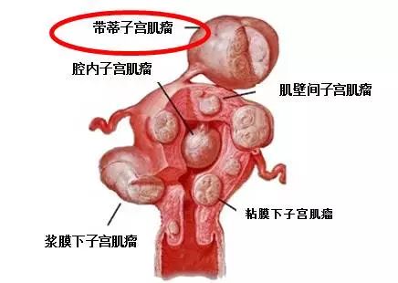 女性私护